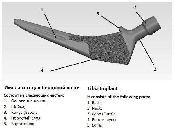 Model Tibijalnog Implanta za zamenu kukova - Image 9