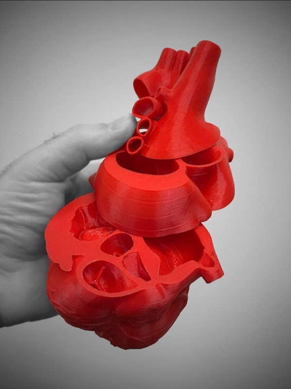3D Štampani Model Ljudskog Srca
